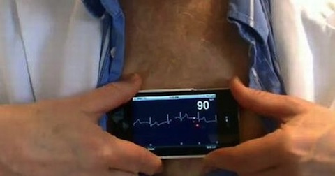 AliveCor-iPhone-ECG-3