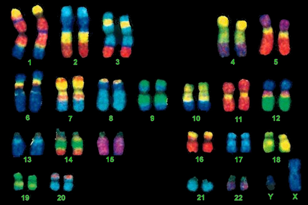 Chromosome lovelifeandbegentle.blogspot.kr_1000