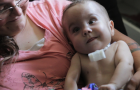 3D 프린터, 생후 2개월 아기의 생명을 구하다!