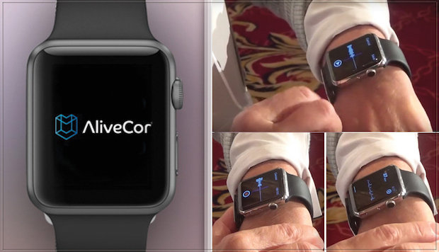 Apple-Watch-ECG-le-bracelet-électrocardiogramme-pour-Apple-Watch