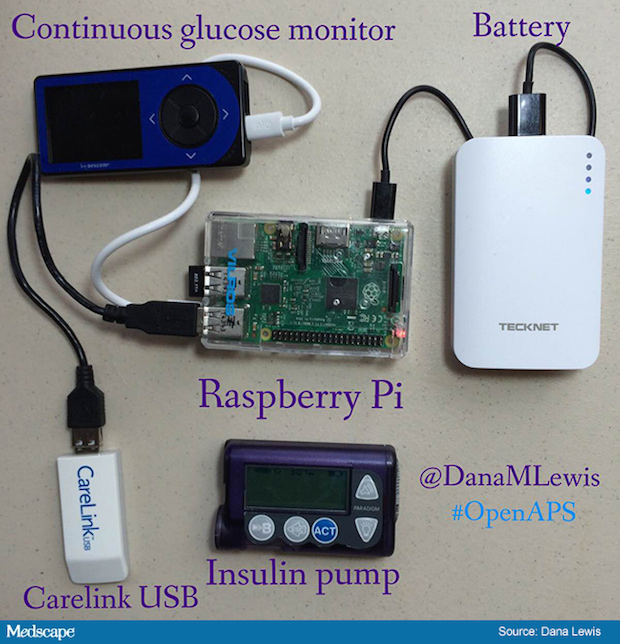 ih_160325_dana_lewis_glucose_monitoring_system_650x675