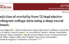 [논문] 12-lead 심전도만으로 환자의 장기간 사망 가능성을 예측한다